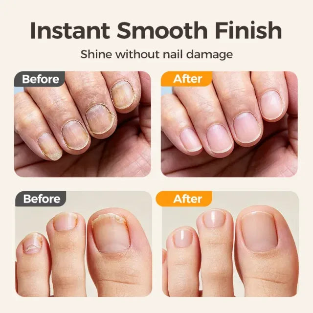 ⏳Time-Limited Special⏰2-in-1 Smart Electric Nail Trimmer & Polisher for All Ages 👨‍👩‍👧‍👦 – Blade-Free, Blood-Free & Stress-Free Nail Care! 💅
